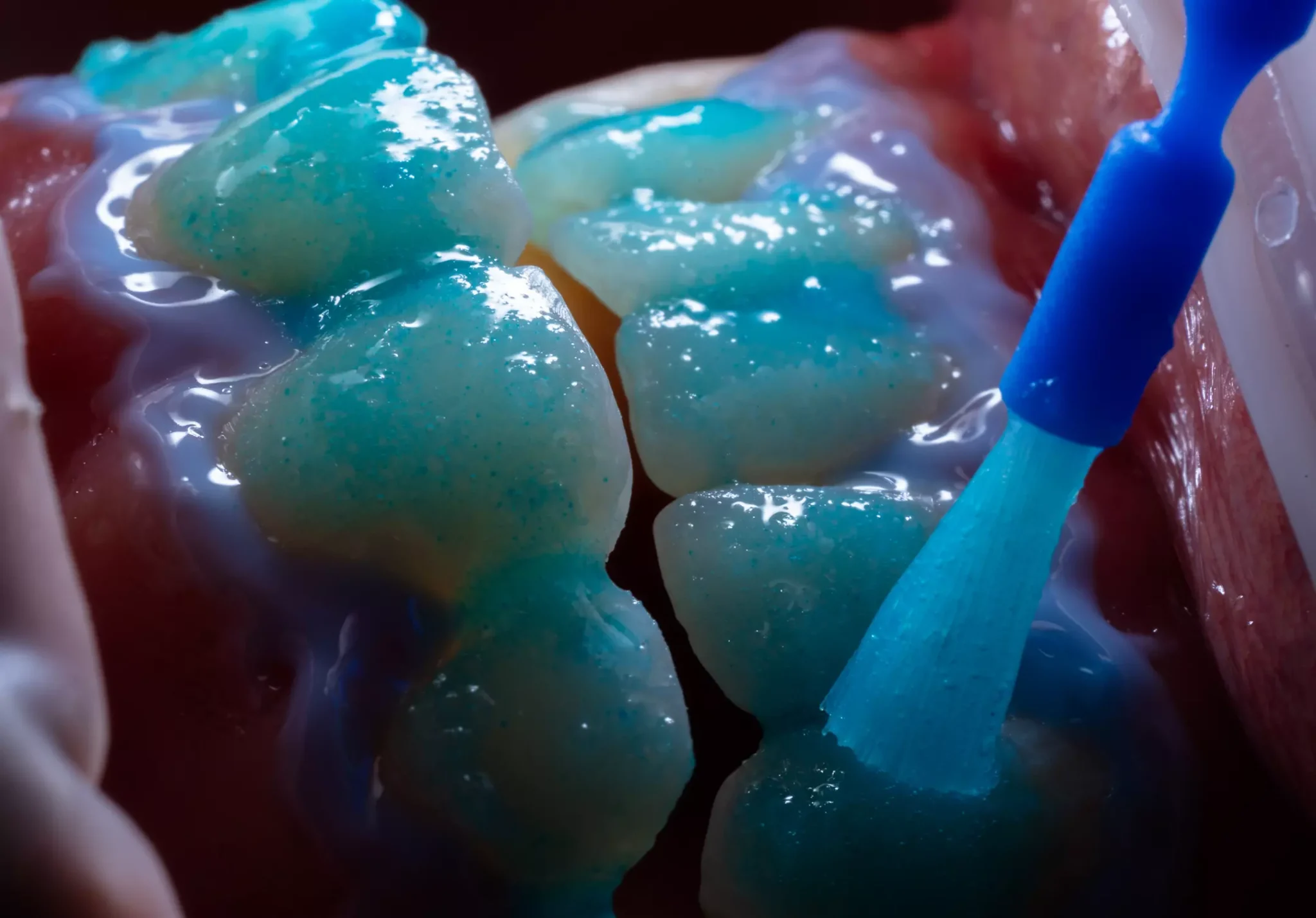 Cuanto-cuesta-un- blanqueamiento-dental-en-Colombia?