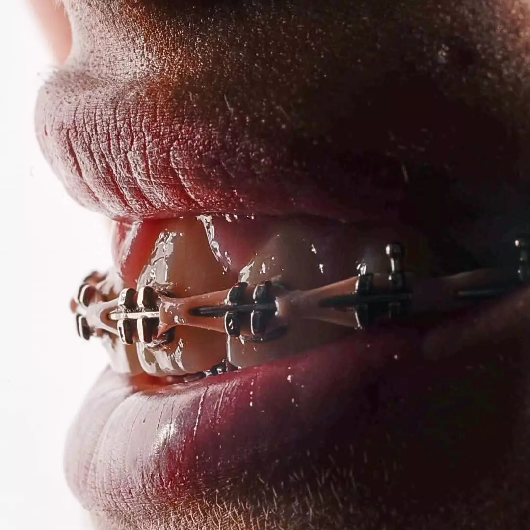 Ortodoncia-Manizales