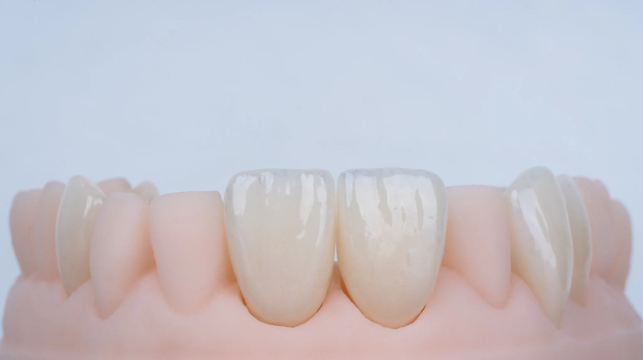 Coronas-dentales-Manizales